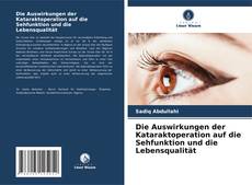 Buchcover von Die Auswirkungen der Kataraktoperation auf die Sehfunktion und die Lebensqualität