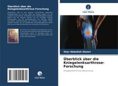Portada del libro de Überblick über die Kniegelenksarthrose-Forschung
