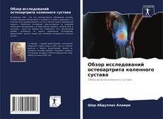 Обложка Обзор исследований остеоартрита коленного сустава
