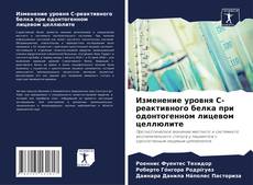 Portada del libro de Изменение уровня С-реактивного белка при одонтогенном лицевом целлюлите