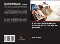 Bookcover of Résistance des incisives maxillaires restaurées par goujons