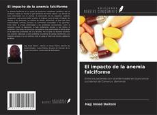 Bookcover of El impacto de la anemia falciforme