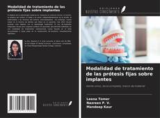 Bookcover of Modalidad de tratamiento de las prótesis fijas sobre implantes