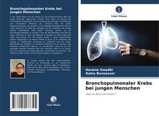 Bookcover of Bronchopulmonaler Krebs bei jungen Menschen