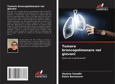 Borítókép a  Tumore broncopolmonare nei giovani - hoz