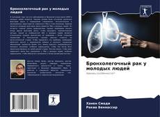 Bookcover of Бронхолегочный рак у молодых людей