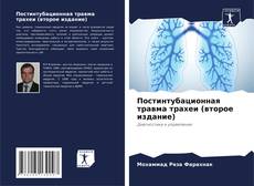 Buchcover von Постинтубационная травма трахеи (второе издание)