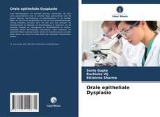 Bookcover of Orale epitheliale Dysplasie