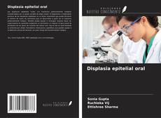 Bookcover of Displasia epitelial oral