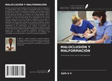 Bookcover of MALOCLUSIÓN Y MALFORMACIÓN