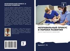 НЕПРАВИЛЬНЫЙ ПРИКУС И ПОРОКИ РАЗВИТИЯ的封面