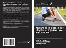 Bookcover of Ruptura de la sindesmosis tibiofibular inferior: ¿qué opciones hay?