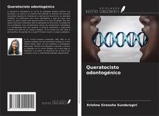 Bookcover of Queratocisto odontogénico