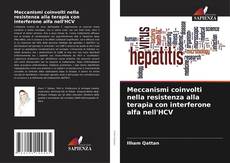 Bookcover of Meccanismi coinvolti nella resistenza alla terapia con interferone alfa nell'HCV