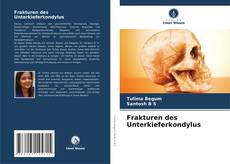 Buchcover von Frakturen des Unterkieferkondylus