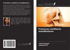 Buchcover von Fracturas condilares mandibulares