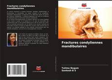 Fractures condyliennes mandibulaires kitap kapağı