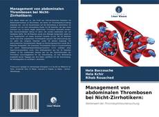 Copertina di Management von abdominalen Thrombosen bei Nicht-Zirrhotikern: