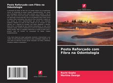 Bookcover of Posto Reforçado com Fibra na Odontologia
