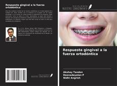 Bookcover of Respuesta gingival a la fuerza ortodóntica