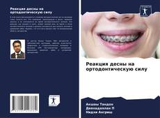 Реакция десны на ортодонтическую силу的封面