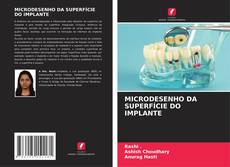 Bookcover of MICRODESENHO DA SUPERFÍCIE DO IMPLANTE