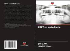 Bookcover of CBCT en endodontie