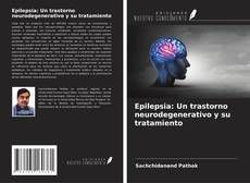 Bookcover of Epilepsia: Un trastorno neurodegenerativo y su tratamiento