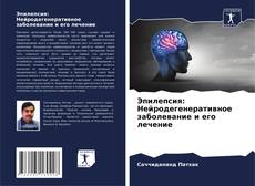 Portada del libro de Эпилепсия: Нейродегенеративное заболевание и его лечение