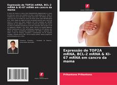 Bookcover of Expressão de TOP2A mRNA, BCL-2 mRNA & KI-67 mRNA em cancro da mama