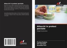 Capa do livro de Attacchi in protesi parziale 