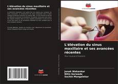 Bookcover of L'élévation du sinus maxillaire et ses avancées récentes