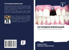 Buchcover von ОСТЕОДЕНСИФИКАЦИЯ