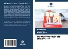 Plattformwechsel bei Implantaten的封面