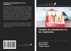 Bookcover of Cambio de plataforma en los implantes