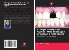 Bookcover of Cirurgia de Implante Guiado - Uma abordagem previsível e mais segura