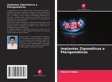 Обложка Implantes Zigomáticos e Pterigomáticos
