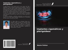 Bookcover of Implantes cigomáticos y pterigoideos