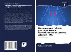 Bookcover of Выполнение гибкой уретероскопии с использованием лазера Холиум - ИАГ