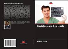 Bookcover of Radiologie médico-légale