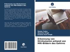 Bookcover of Erkennung von Hirntumoren anhand von MRI-Bildern des Gehirns