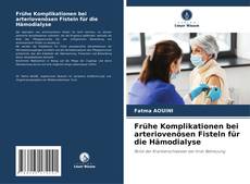Buchcover von Frühe Komplikationen bei arteriovenösen Fisteln für die Hämodialyse