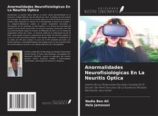 Anormalidades Neurofisiológicas En La Neuritis Óptica kitap kapağı