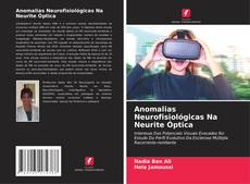 Capa do livro de Anomalias Neurofisiológicas Na Neurite Óptica 