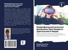 Capa do livro de Нейрофизиологические Аномалии При Неврите Зрительного Нерва 