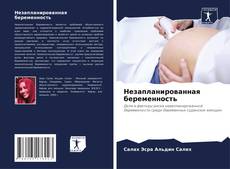 Bookcover of Незапланированная беременность