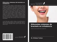 Copertina di Diferentes sistemas de brackets en ortodoncia
