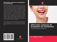 Capa do livro de Diferentes sistemas de braquetes em Ortodontia 