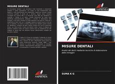 Bookcover of MISURE DENTALI