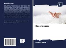 Portada del libro de Косолапость